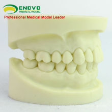 DENTAL05(12564) Cavity Preparation Jaw Model for Dental Student Training